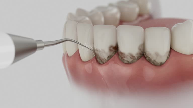 Reliable Dental Implants contractor in Perry, FL by Smile Center Dentistry